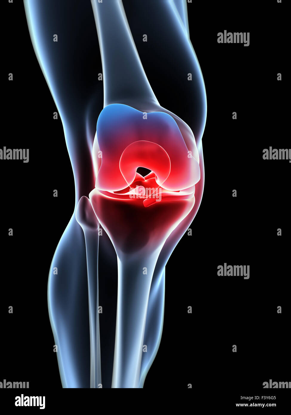 Knee Cap Stock Photos & Knee Cap Stock Images Alamy