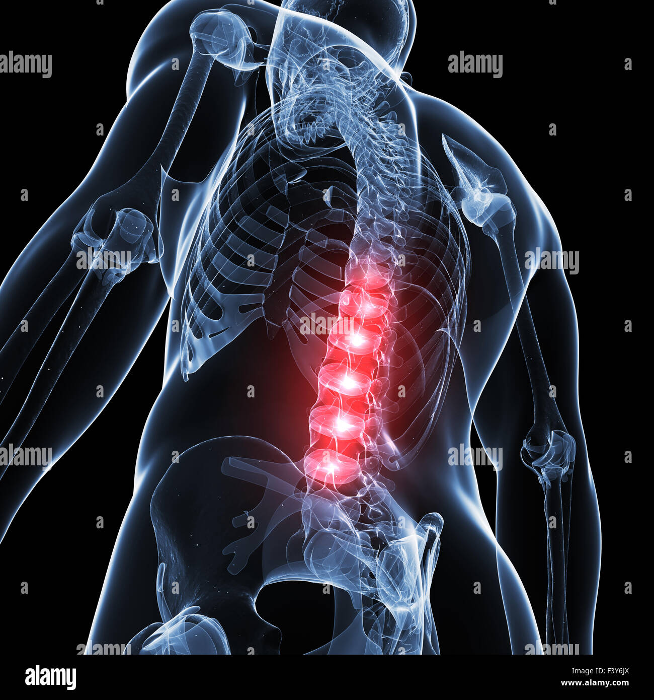 3d rendered illustration of a painful back Stock Photo - Alamy