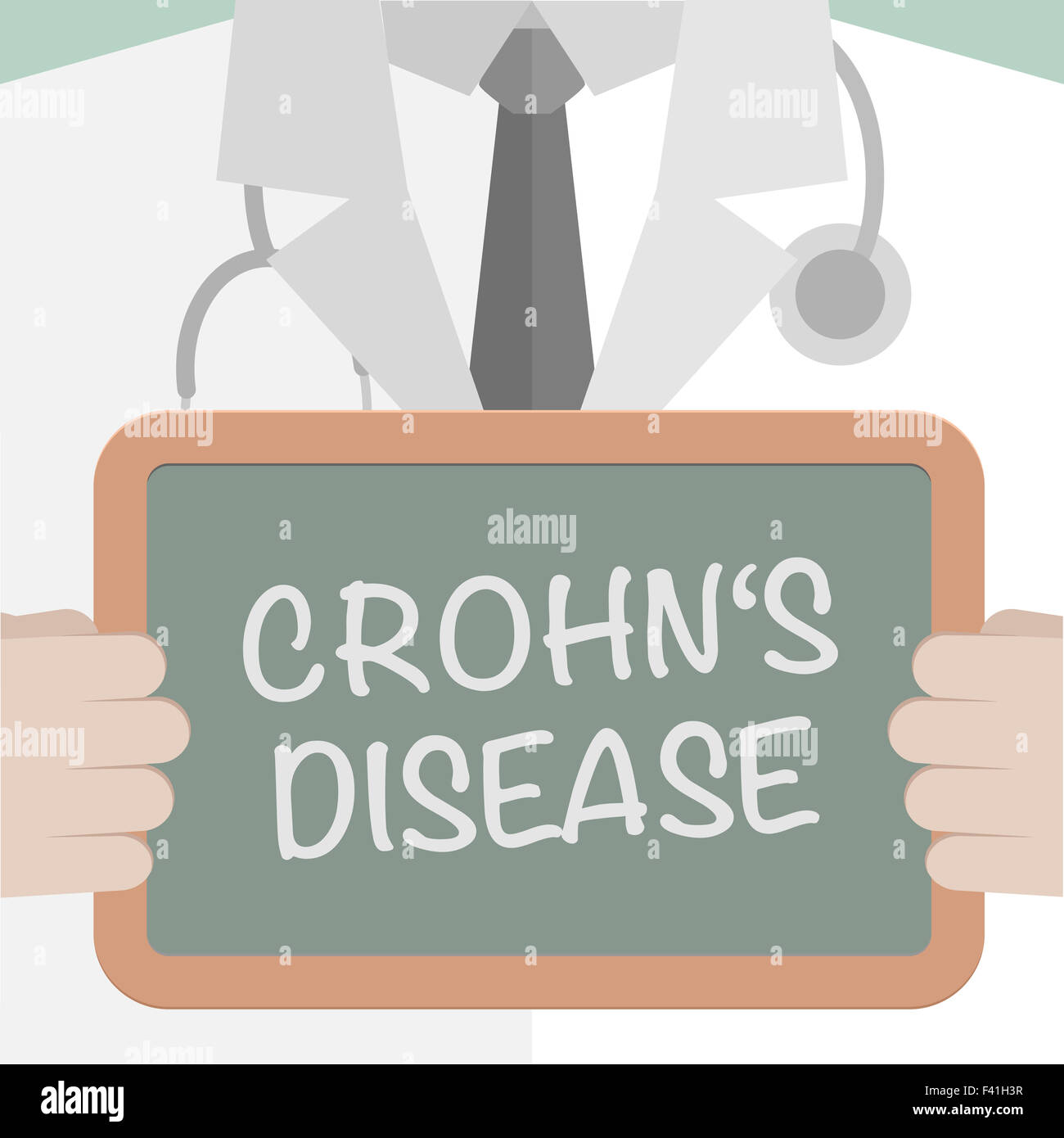 Medical Board Crohns Disease Stock Photo