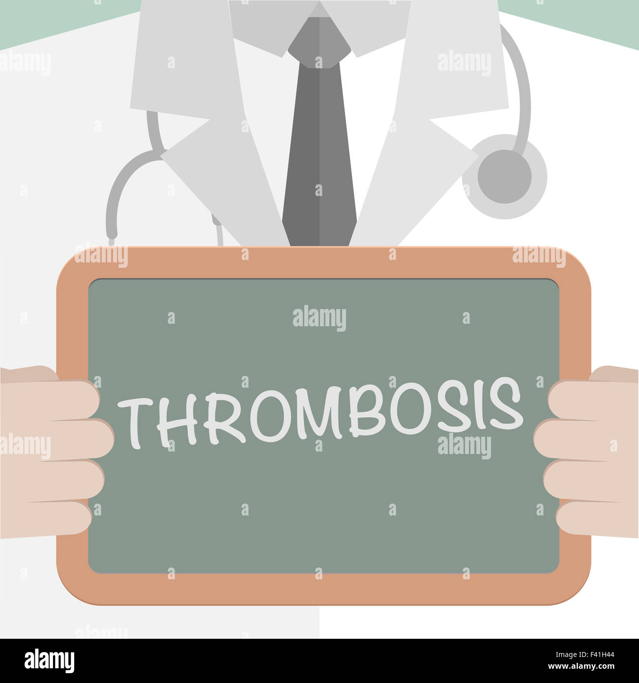 Medical Board Thrombosis Stock Photo