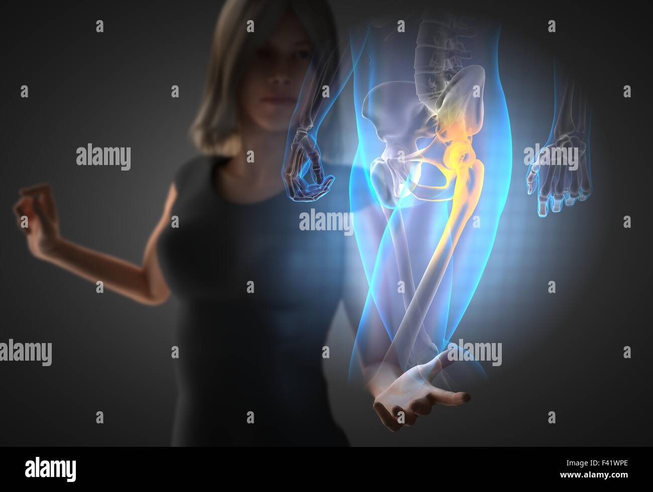 woman and hologram with hip radiography Stock Photo - Alamy