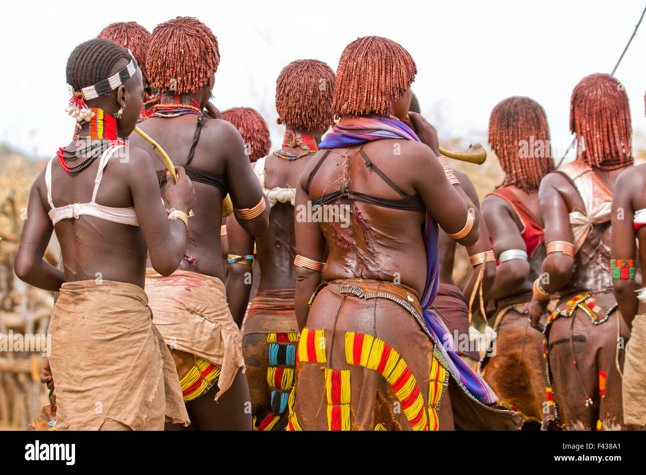 The raw scars on a Hamar woman's back after being whipped at a 'Jumping of the Bull' ceremony. Omo Valley Ethiopia Stock Photo