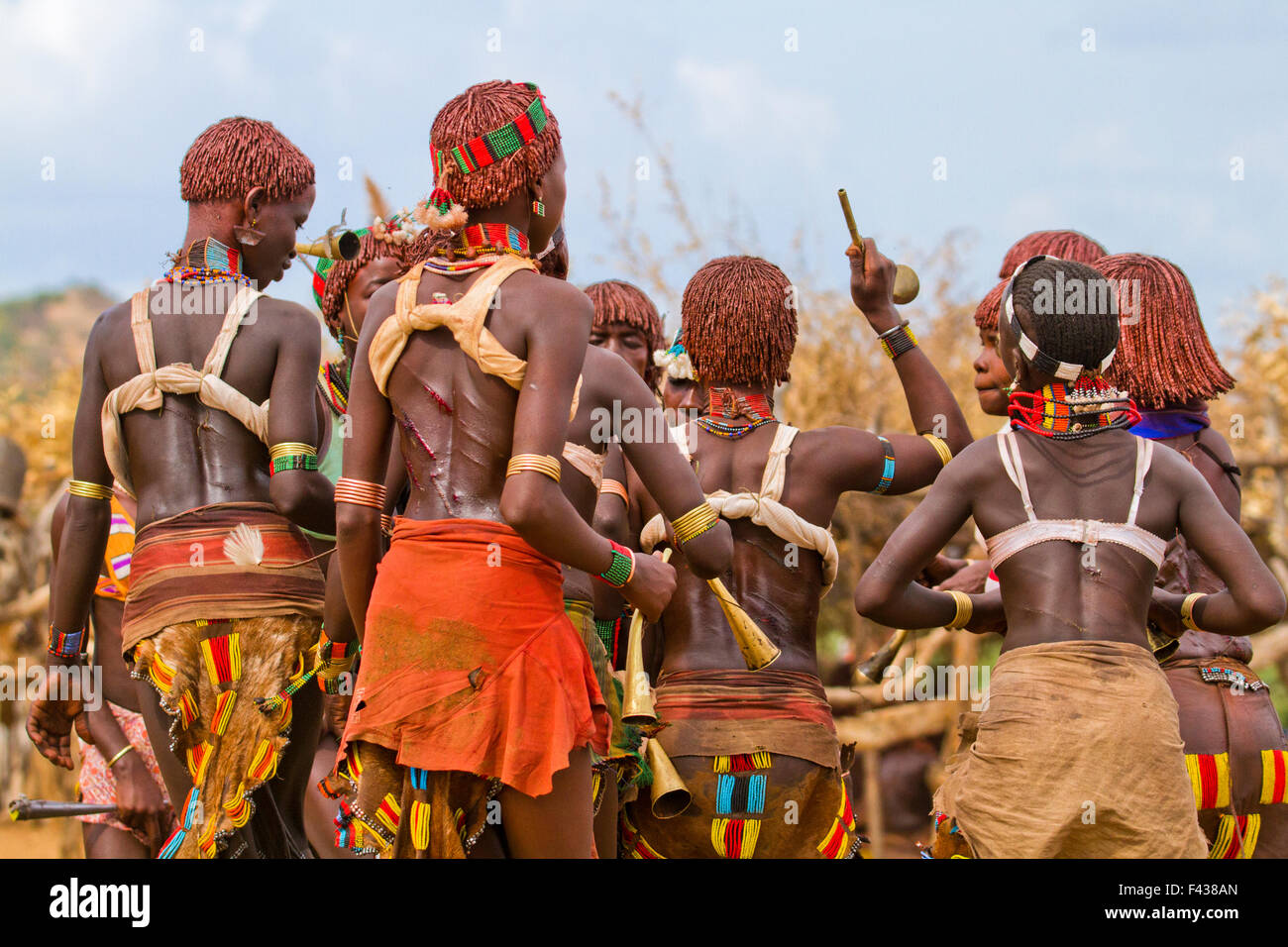 The raw scars on a Hamar woman's back after being whipped at a 'Jumping of the Bull' ceremony. Omo Valley Ethiopia Stock Photo
