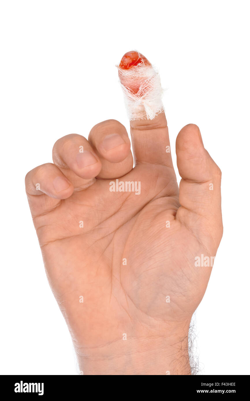 Man is putting the bandage on the wound. Bleeding injury. Deep cut with a  knife. Stock Photo