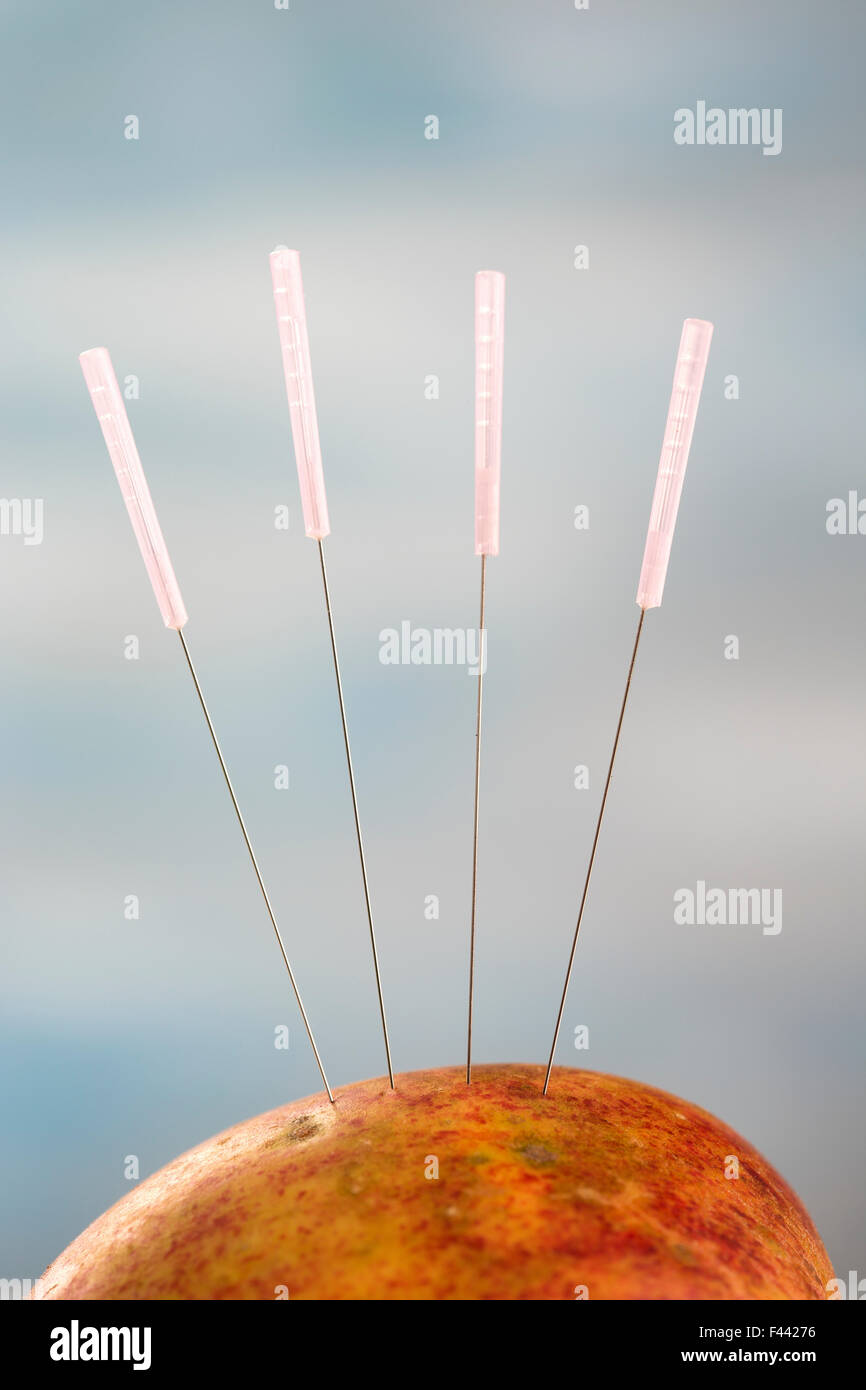 Acupuncture needle hires stock photography and images Alamy