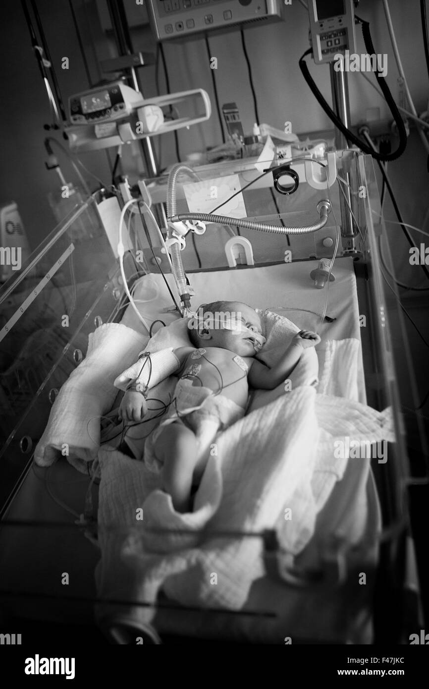 Assisted breathing Black and White Stock Photos & Images - Alamy