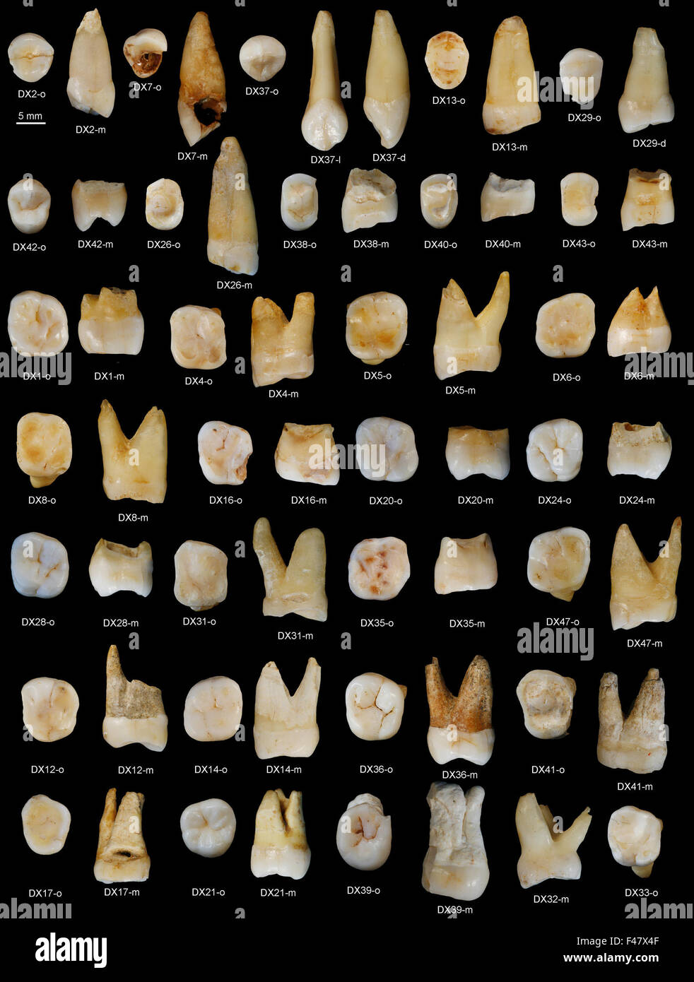 (151015) -- BEIJING, Oct. 15, 2015 (Xinhua) -- Photo provided by the Institute of Vertebrate Paleontology and Paleoanthropology under the Chinese Academy of Sciences shows tooth fossils found in Daoxian county in central China's Hunan Province. These tooth fossils indicate the early form of modern homo sapiens appeared in the region more than 80,000 years ago. The 47 fossils, found in Daoxian county, date back from 80,000 to 120,000 years and are believed to be the oldest remains of a completely modern form scientists have known in the east Asia region, the study's leading scientists said on O Stock Photo