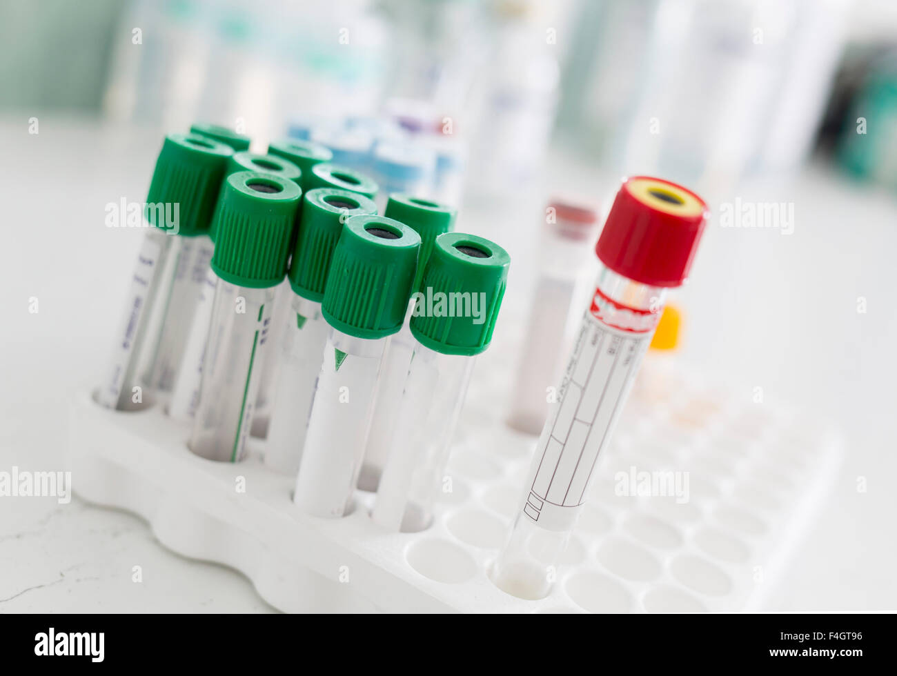 A rack of different vacuum venipuncture test tubes in a hospital Stock Photo Alamy