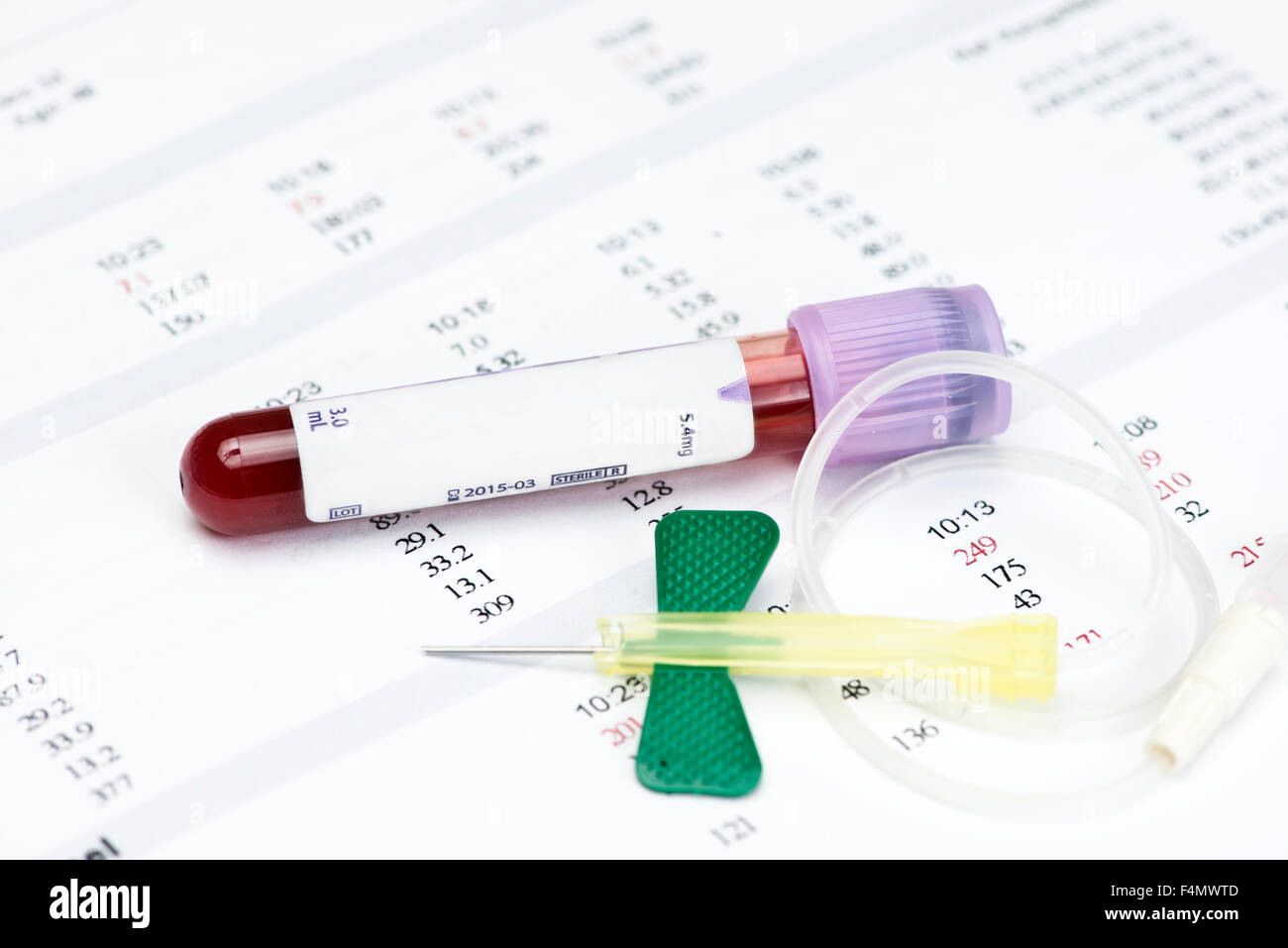 Blood sample in lavender collection tube with catheter and hematology report. Stock Photo