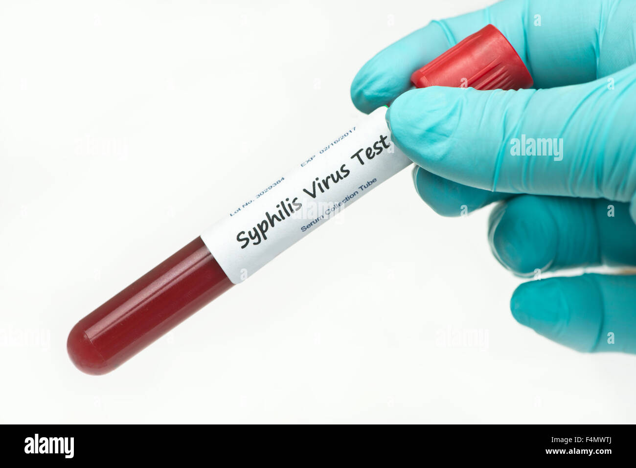 Syphilis virus blood sample collection tube held by technician. Label