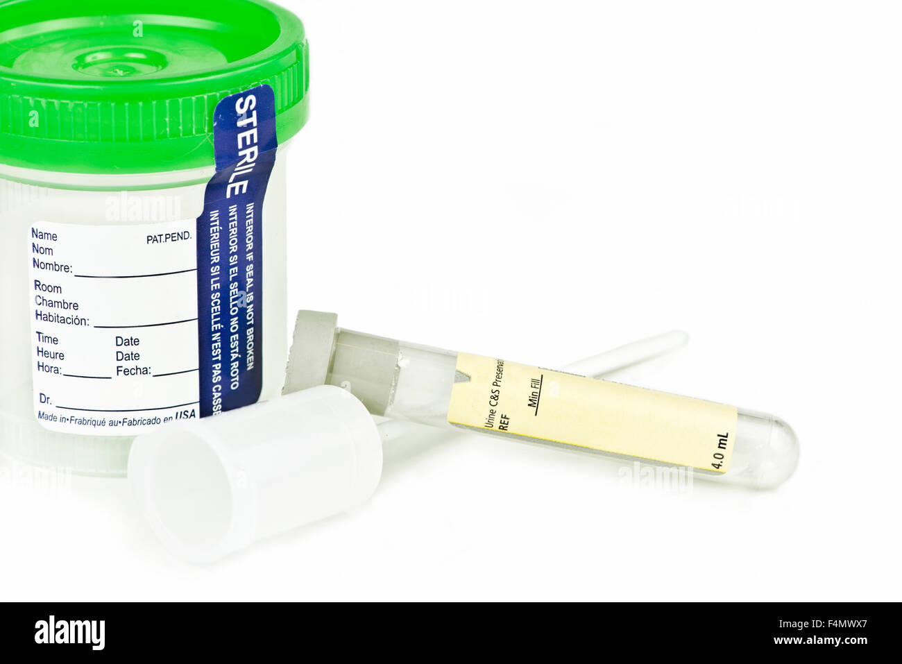 Culture and sensitivity sample tube with urine sample specimen cup
