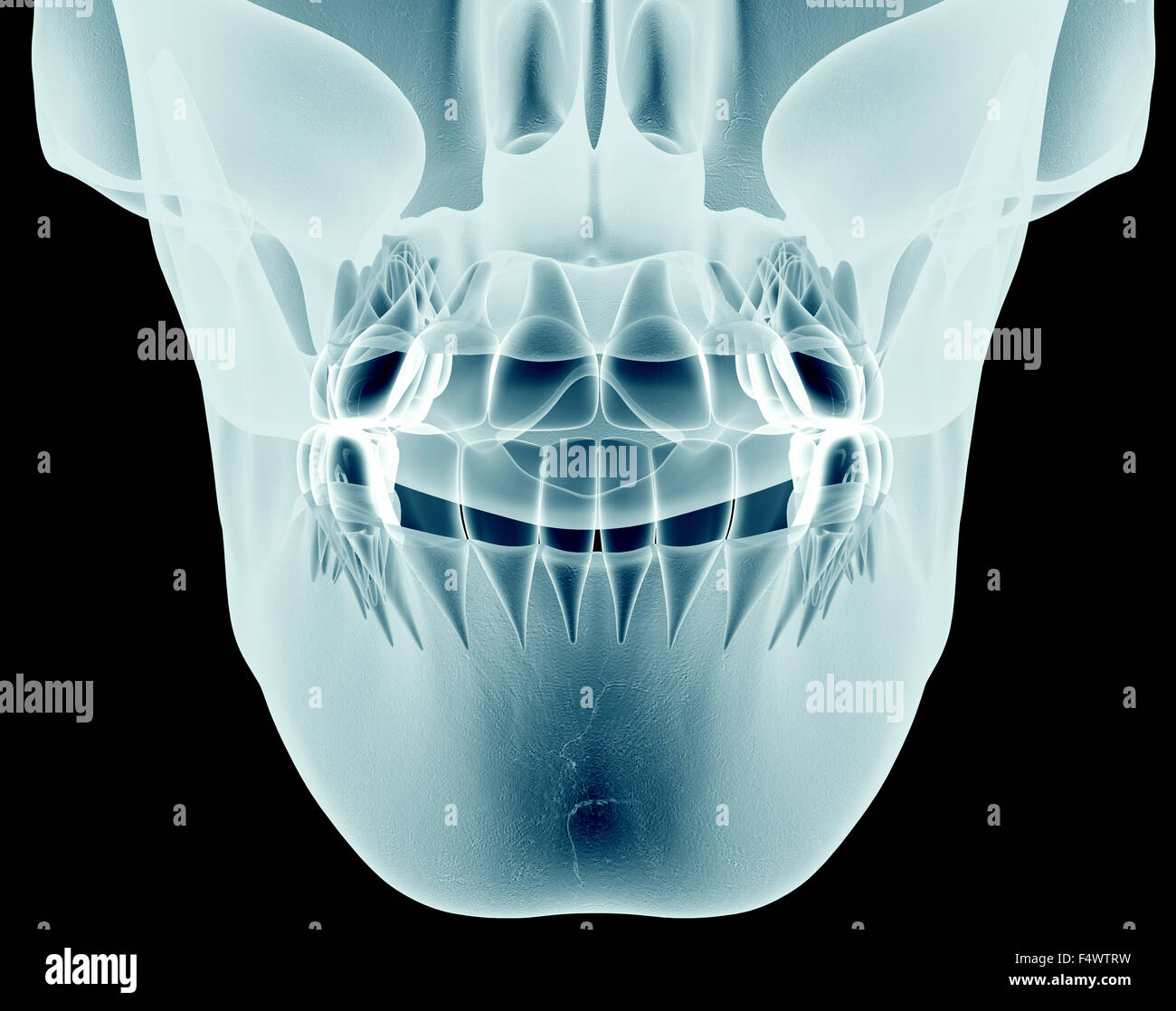 xray image of a jaw with teeth Stock Photo Alamy