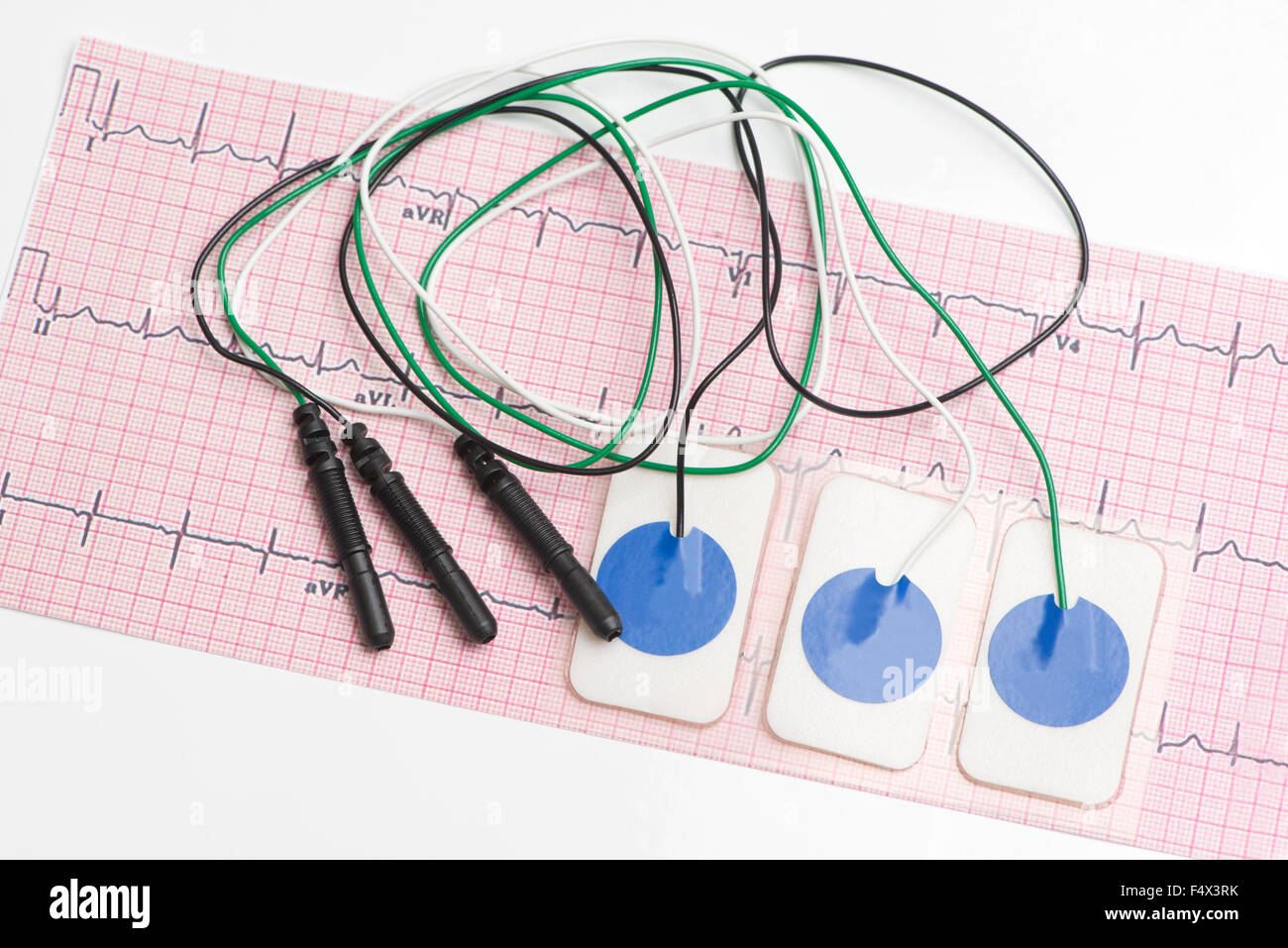 Electrocardiogram leads and electrocardiograph on white tabletop. Stock Photo