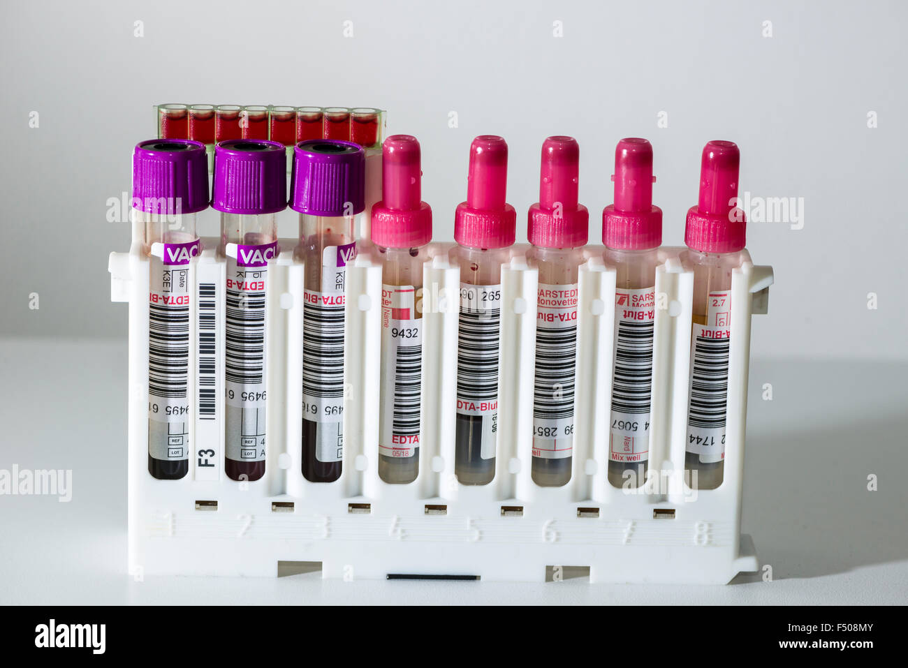Many capillary tubes, filled with blood for diagnose the blood type, are sorted in a white rack Stock Photo