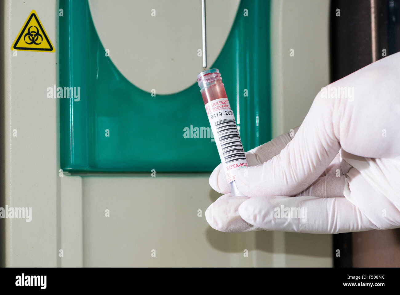 Blood is taken out of a capillary tube by a pipette for diagnosis of the blood count, the haemogram Stock Photo