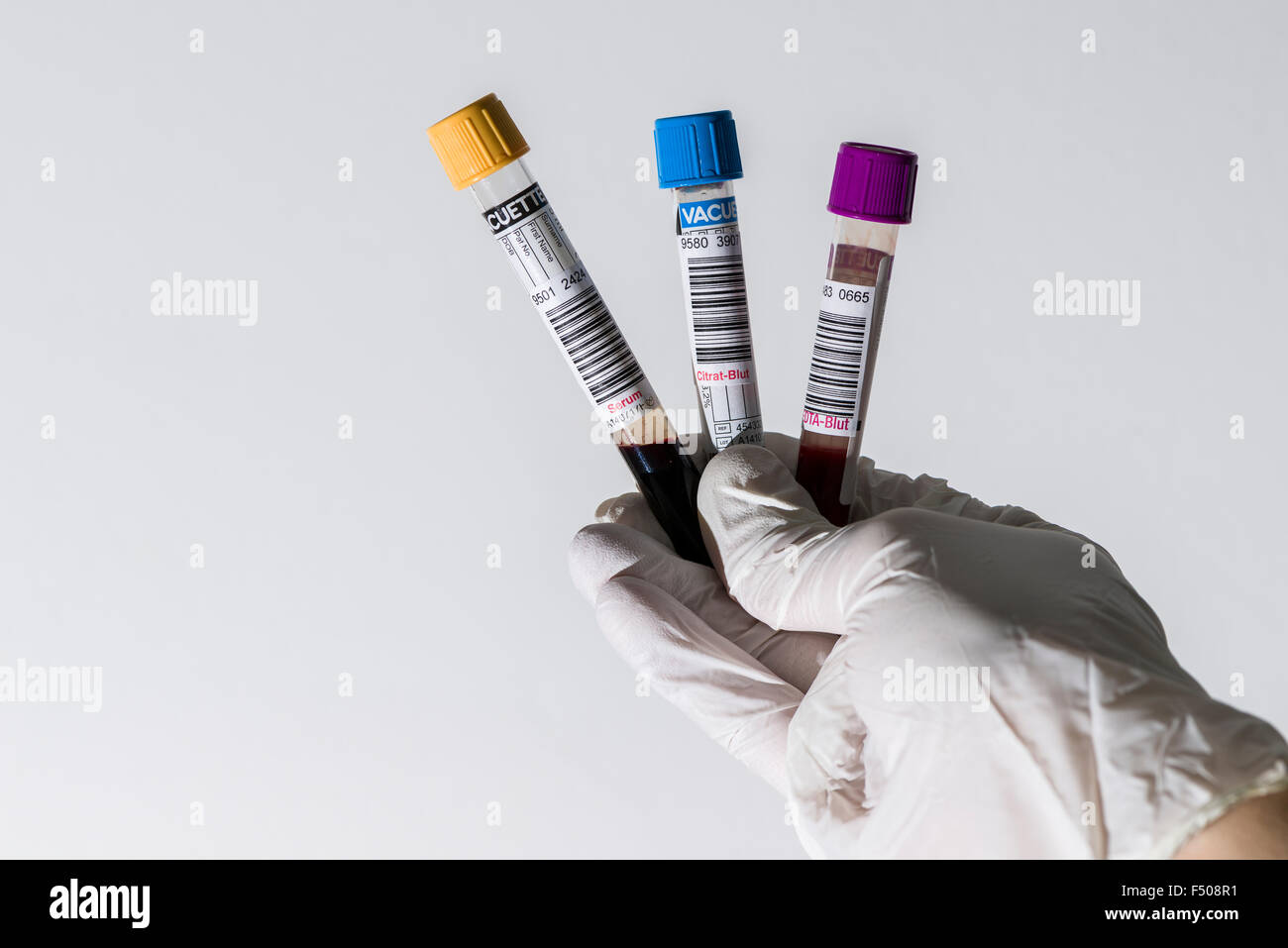 Edta Tube High Resolution Stock Photography And Images Alamy