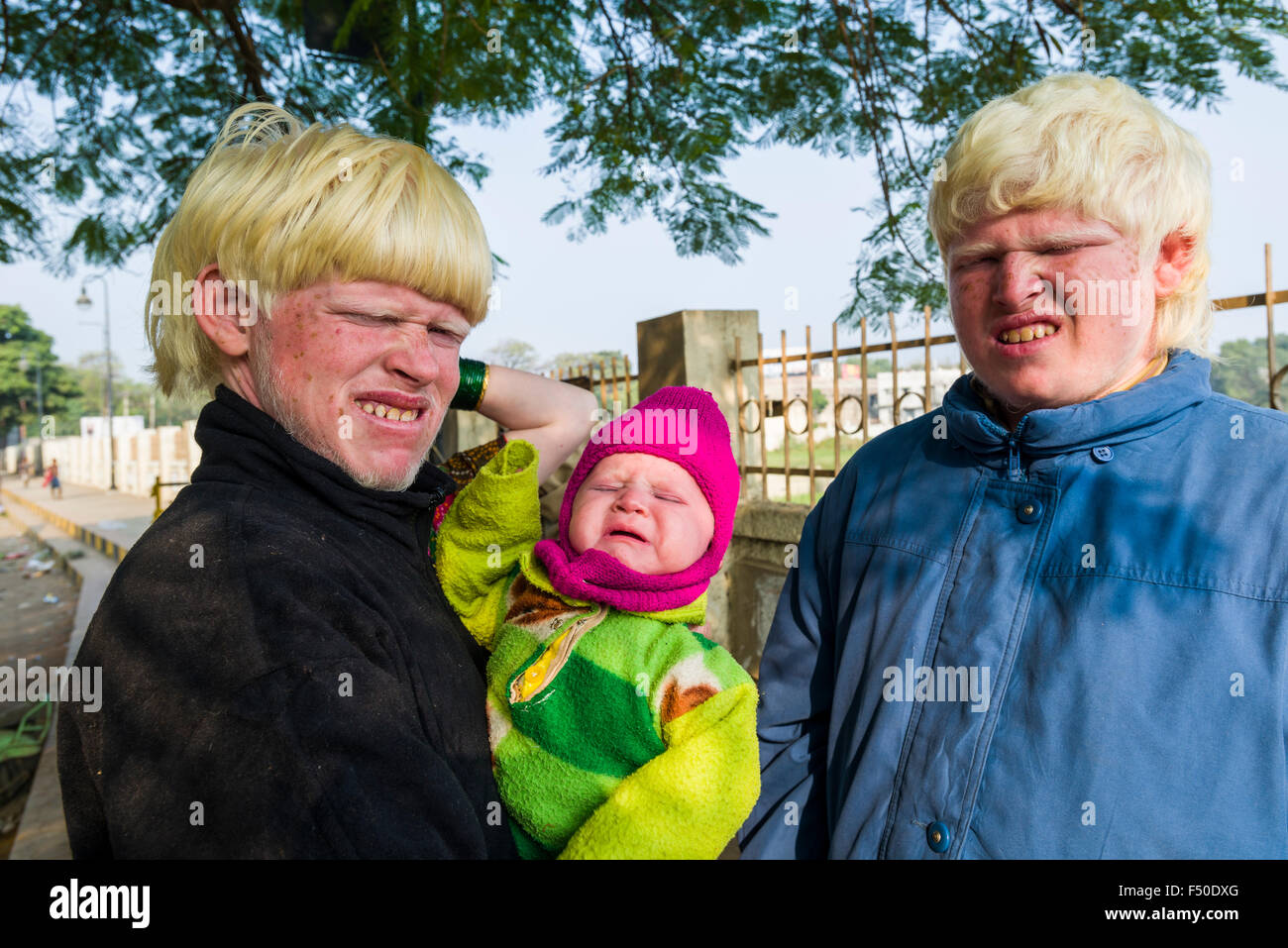 Portraits of Albinos with extremely pale skin and near-white hair, covering their eyes from the sunlight Stock Photo