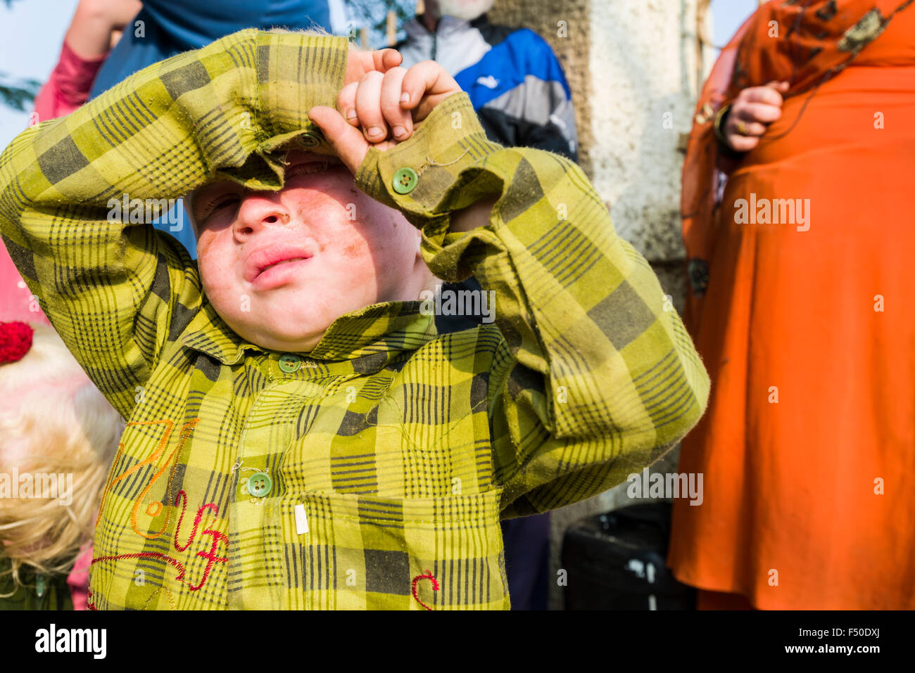 Portrait of an Albino boy with extremely pale skin and near-white hair, covering his eyes from the sunlight Stock Photo