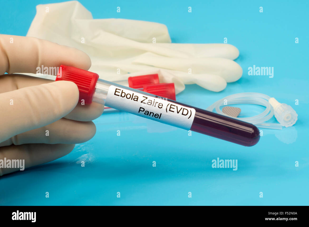 Ebola Zaire blood test panel lab sample held by lab technician. Label is fictitious. Stock Photo
