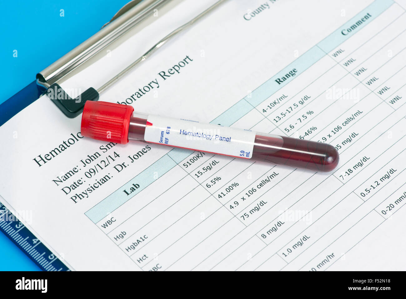 Hematology lab panel blood sample tube on patient hematology report. Stock Photo