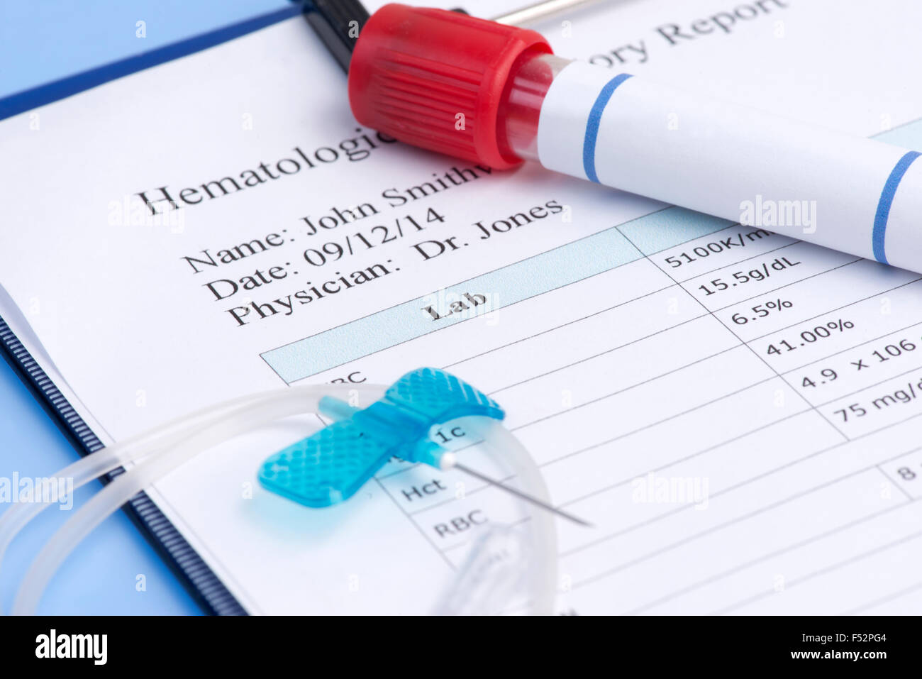 Hematology report with IV needle and blood collection tube. Stock Photo