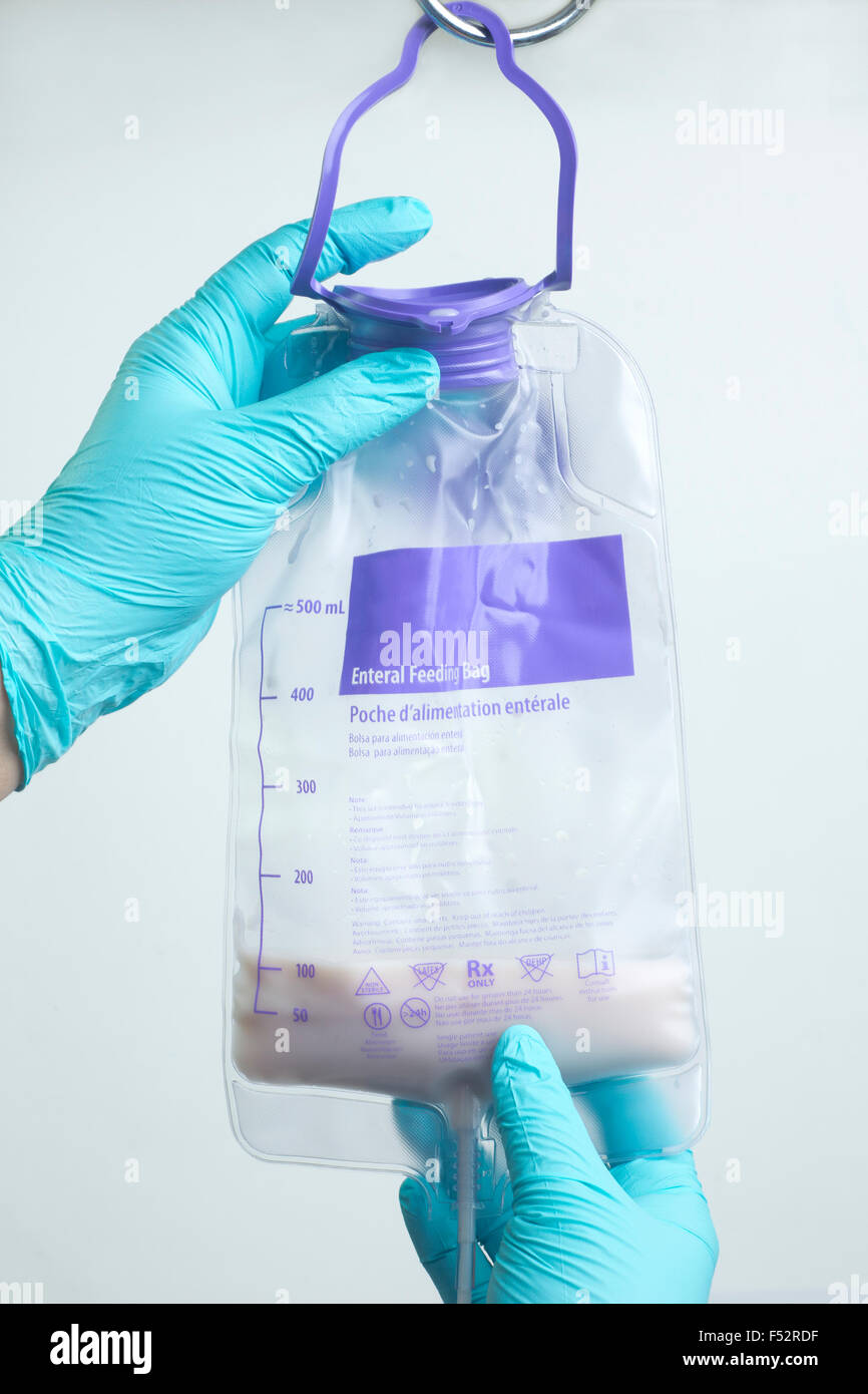 Nurse hangs enteral feeding bag on IV pole Stock Photo Alamy