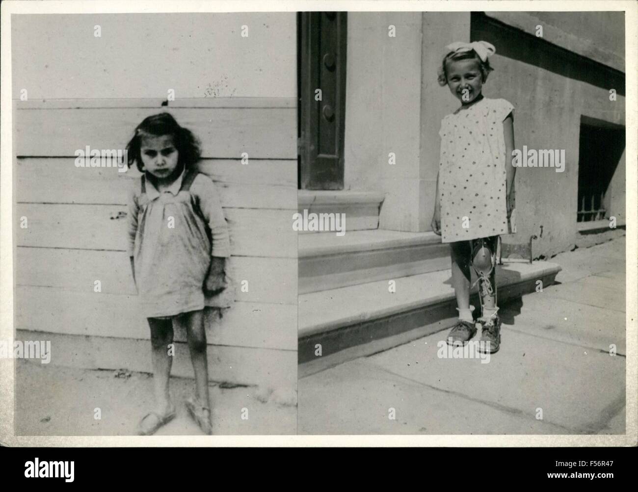 1954 - Athens: The name child before and after treatment at the Crippled children 'center, under near East Foundation. © Keystone Pictures USA/ZUMAPRESS.com/Alamy Live News Stock Photo