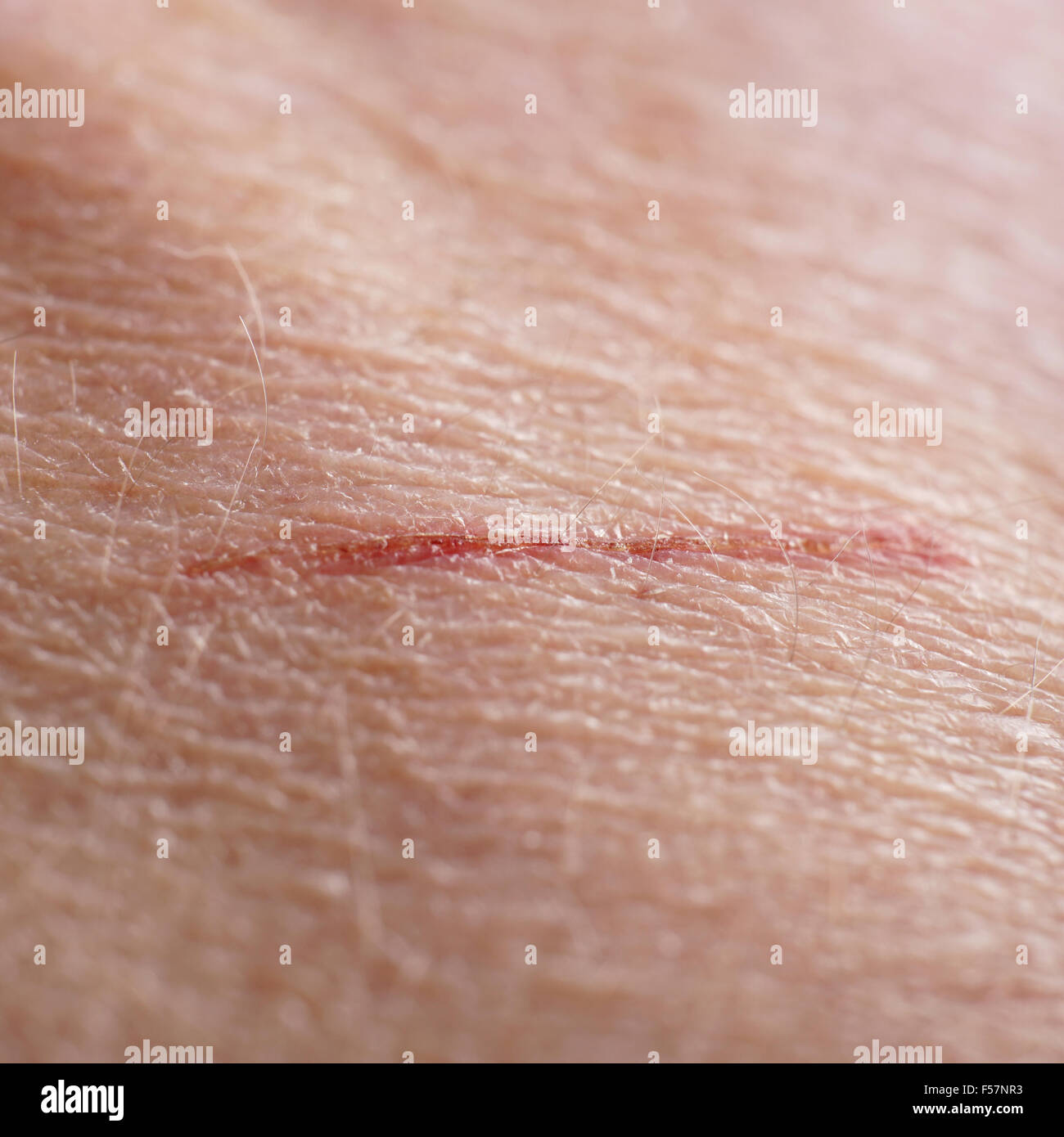 skin cut macro Stock Photo - Alamy