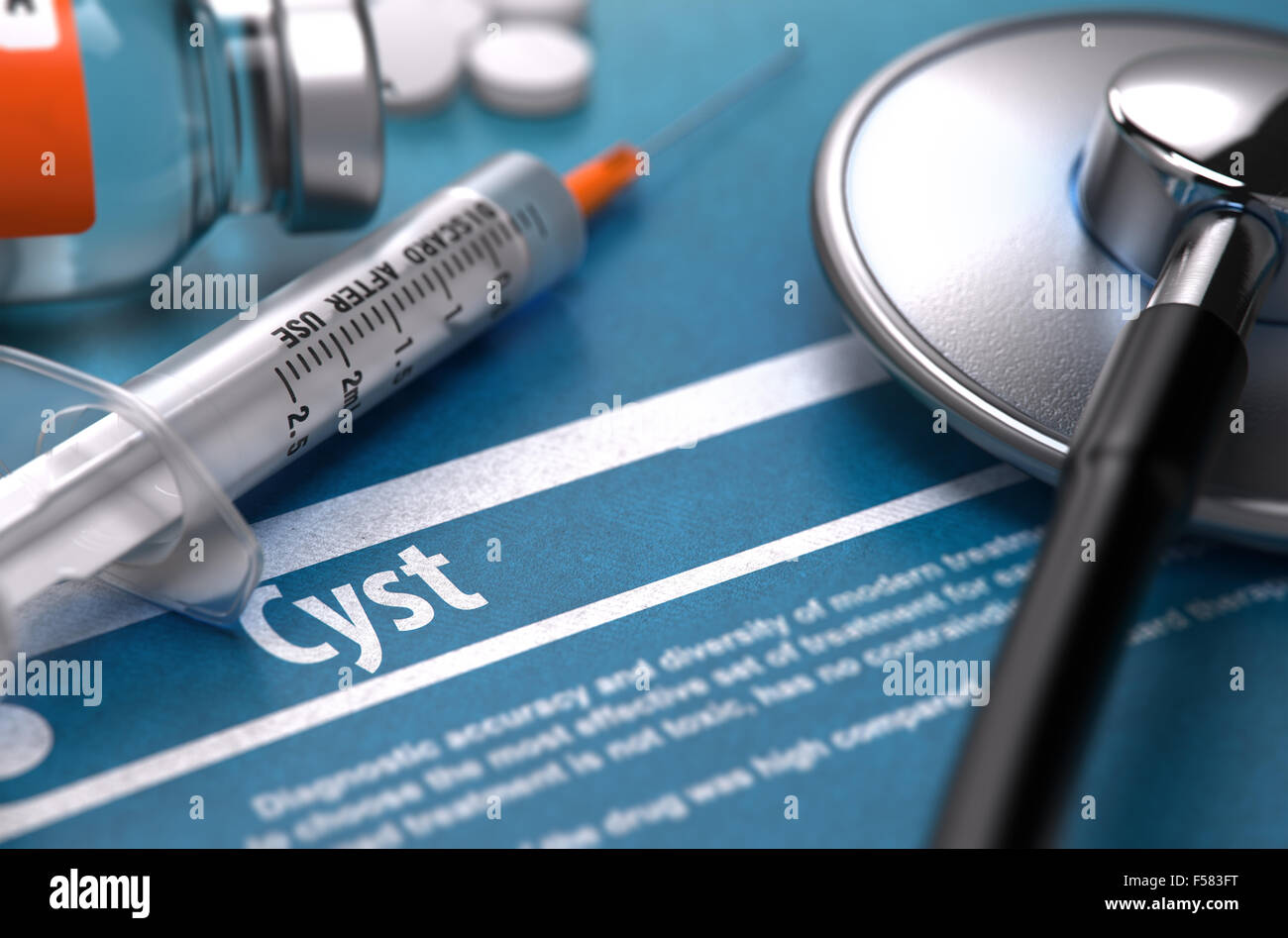 Cyst - Printed Diagnosis on Blue Background and Medical Composition - Stethoscope, Pills and Syringe. Medical Concept. Blurred I Stock Photo