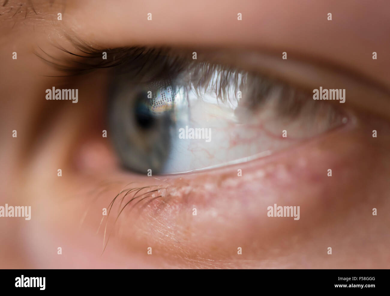 Close-up of a human eye with an inserted contact lens. Visible lens data imprint, written in small dots on the lens Stock Photo