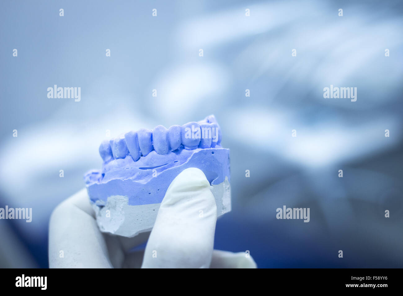 Dental mold dentist clay teeth plate ceramic colored cast model showing  tooth decay and gums of patient in dental clinic surgery for diagnosis and  treatment held in sterile glove hand of dentist