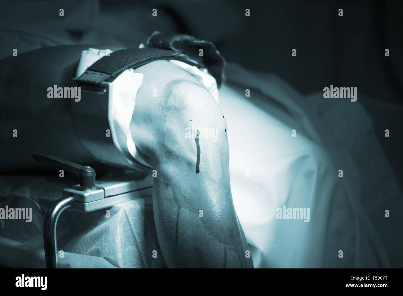 Traumatology orthopedic surgery hospital emergency operating room