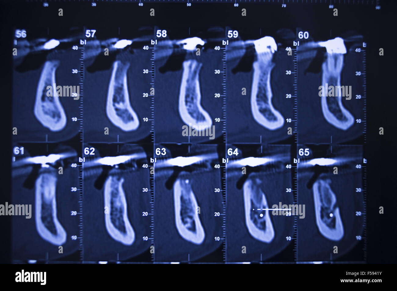 Dental xray scans on scanning viewer in dentists office clinic Stock Photo Alamy