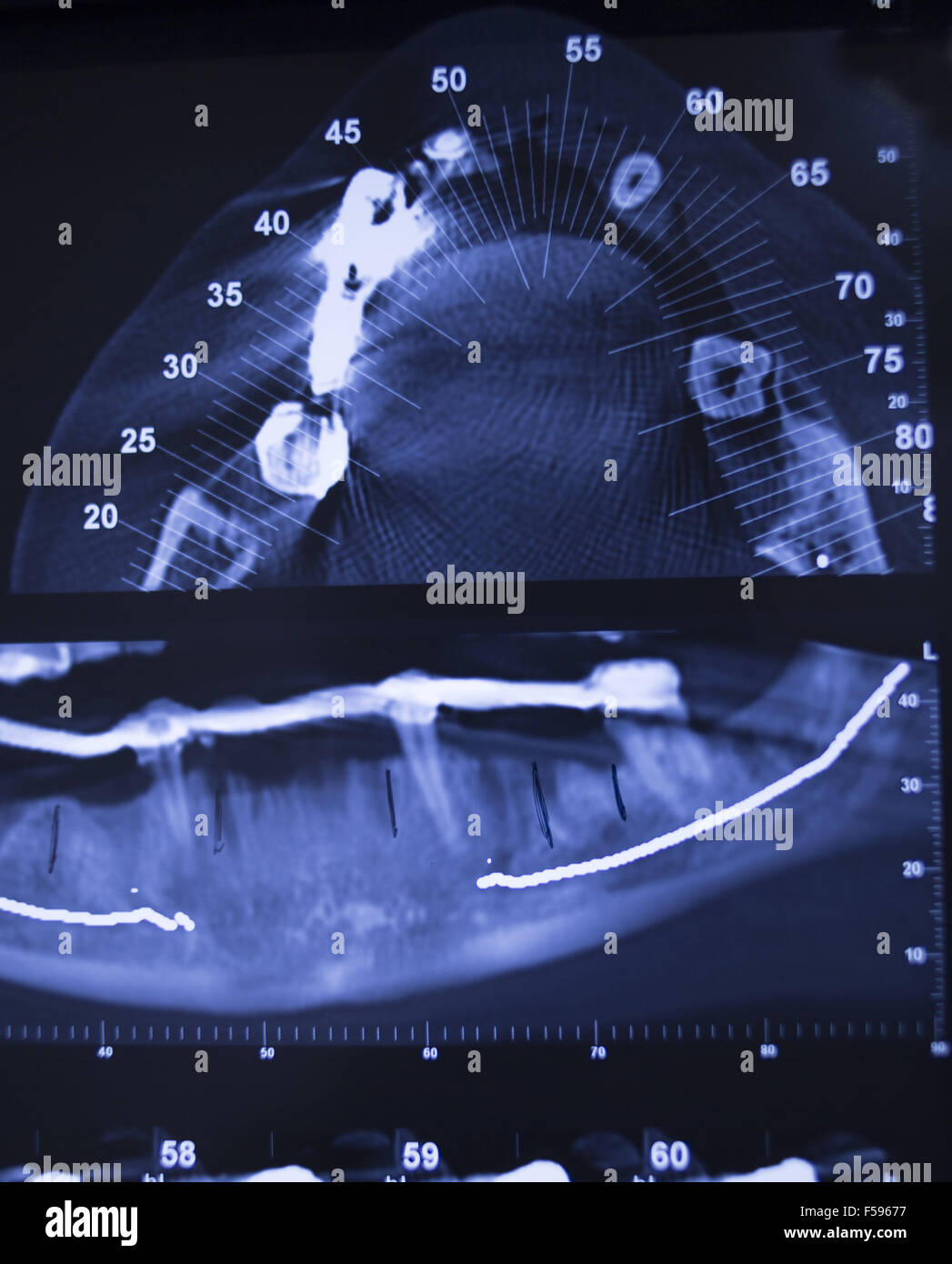 Dental xray scans on scanning viewer in dentists office clinic Stock Photo Alamy