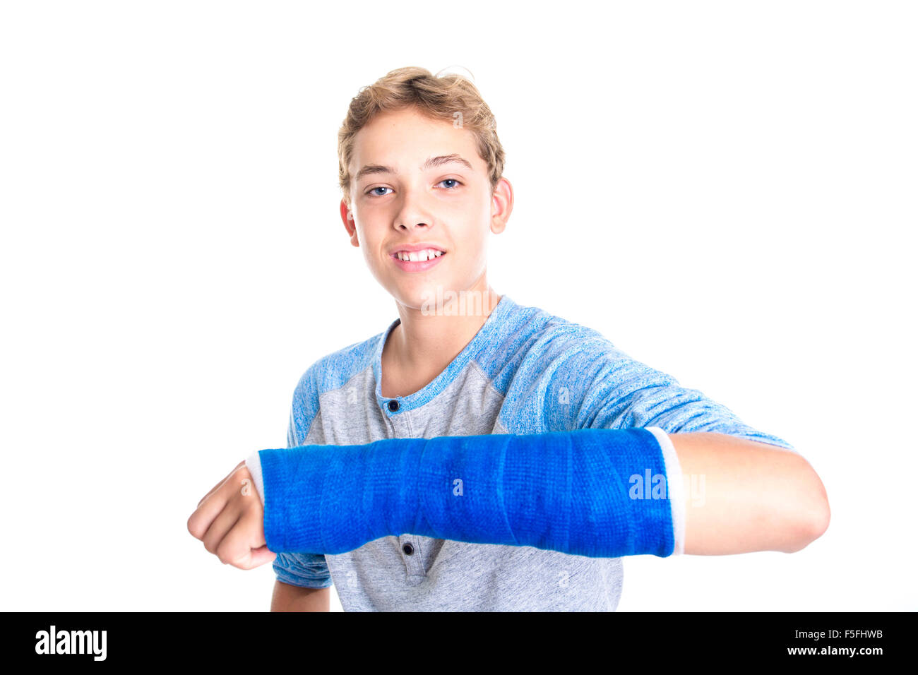 Blue cast on hand and arm isolated on white background Stock Photo