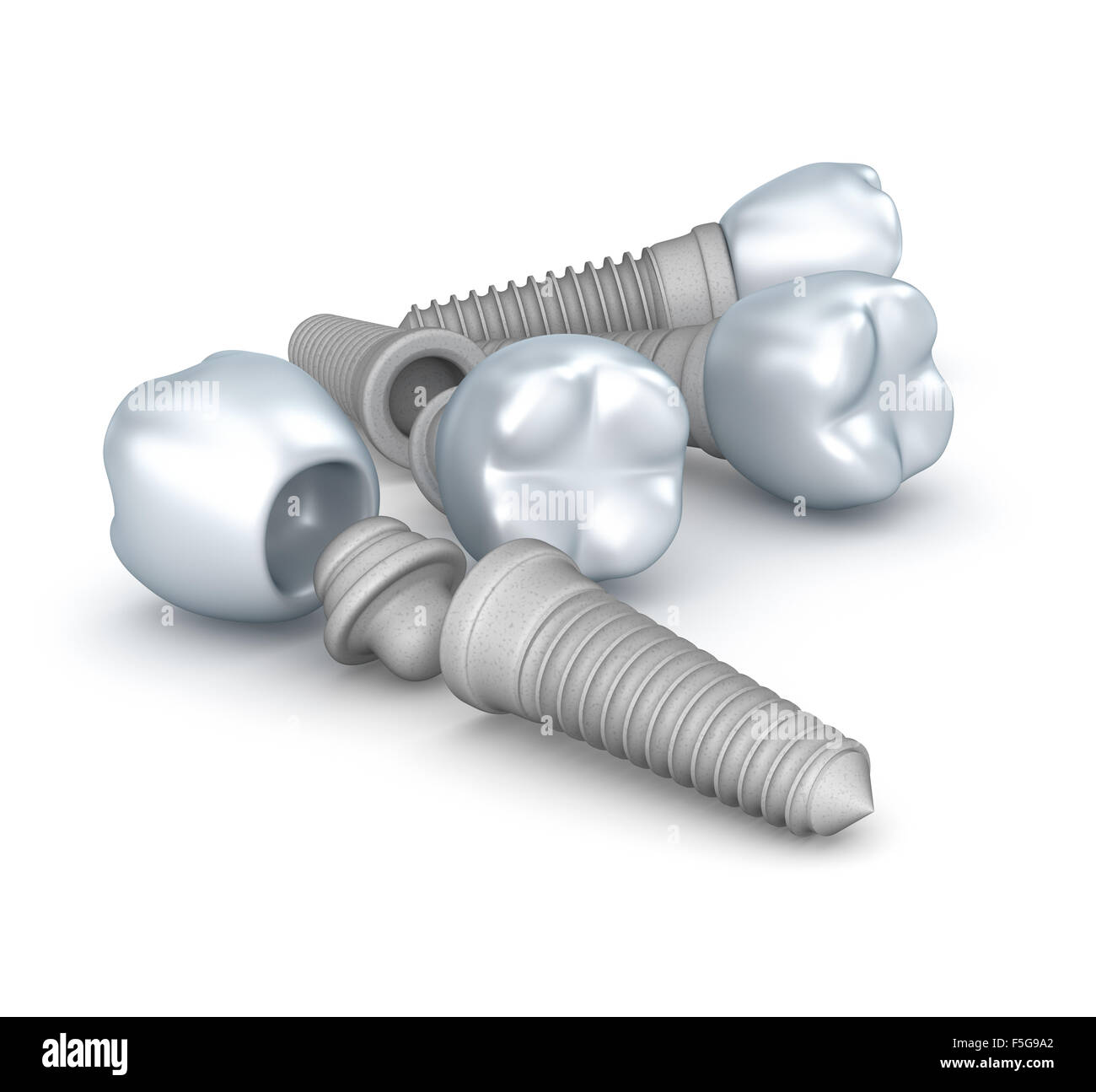 Dental implants, crowns and pins isolated on white Stock Photo