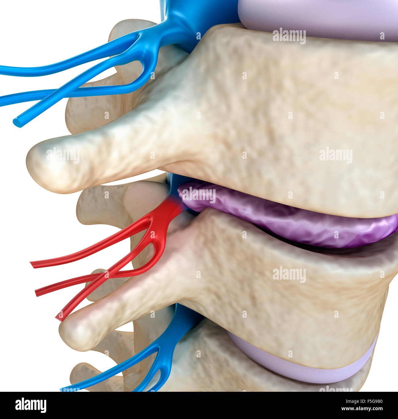 Spinal cord under pressure of bulging disc Stock Photo Alamy