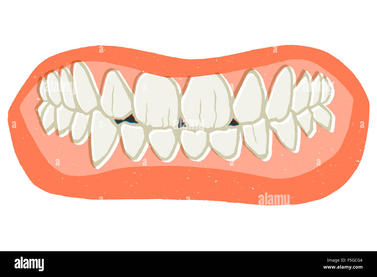 gabapentin teeth clenching