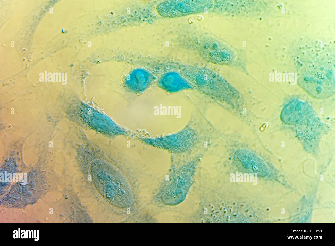 HeLa cervical cancer cells, stained with Coomassie blue, under differencial interference contrast microscope. Stock Photo