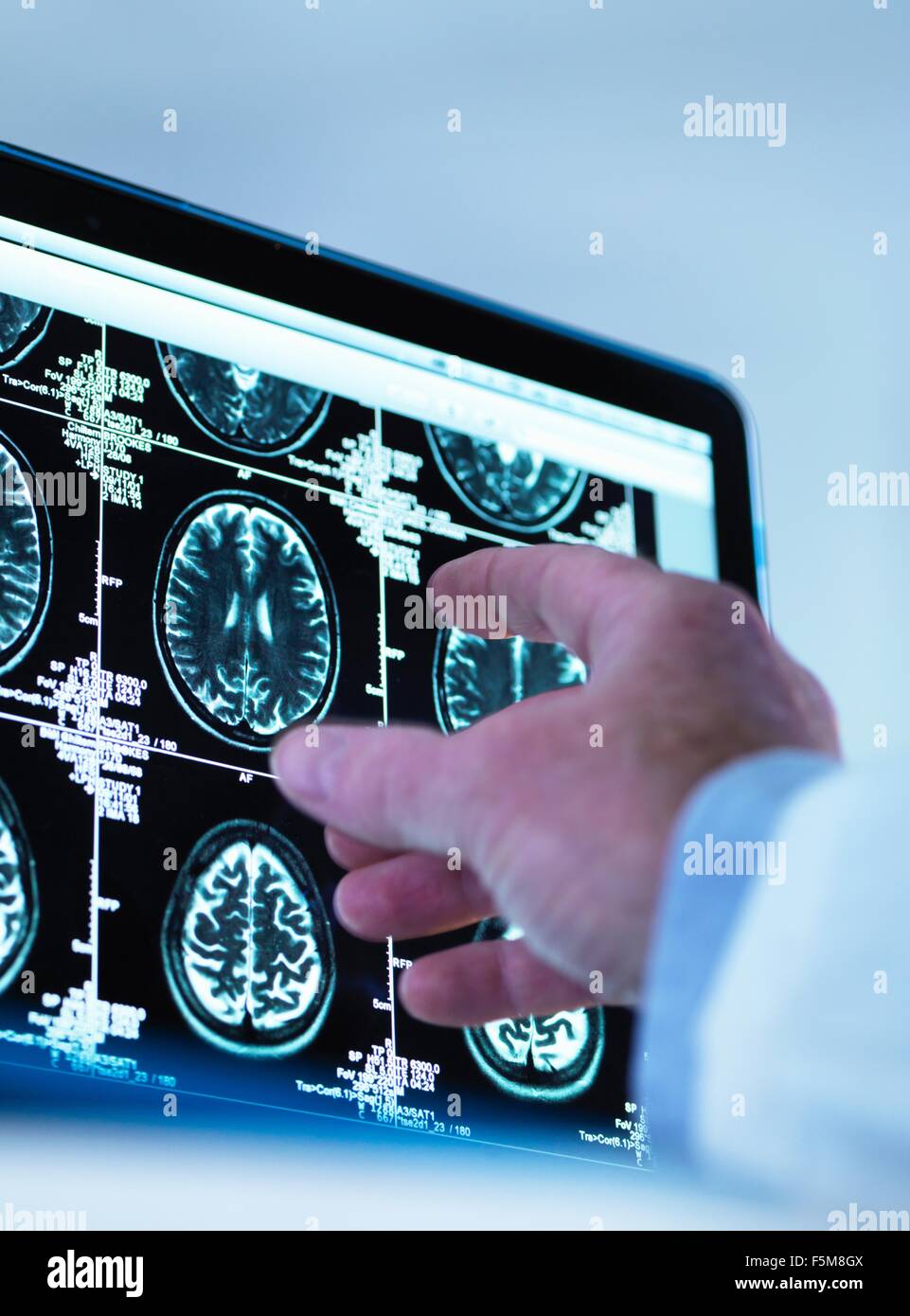 Doctor viewing a series of MRI (Magnetic Resonance Imaging) brain scans on a screen Stock Photo