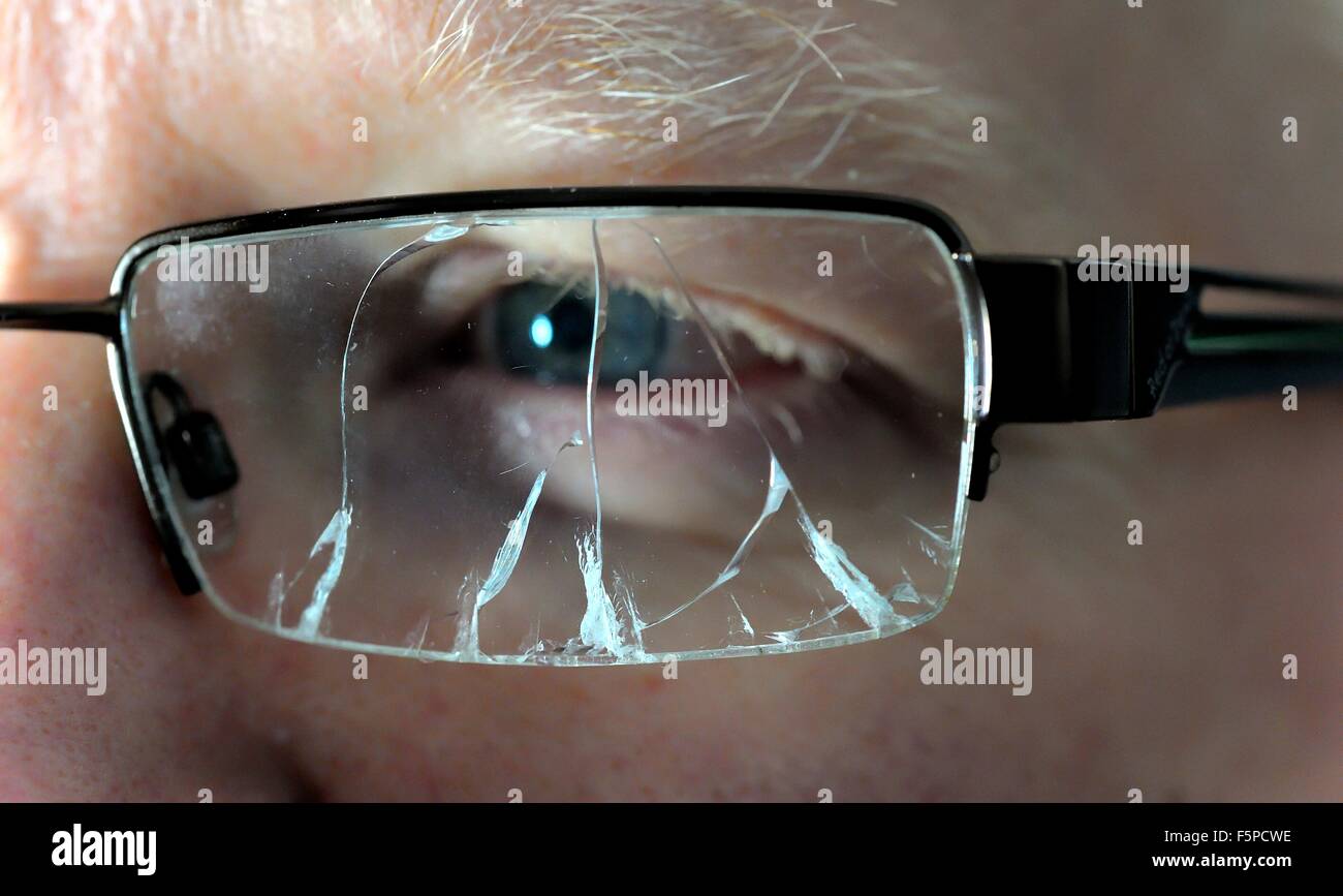 man wearing broken spectacles Stock Photo
