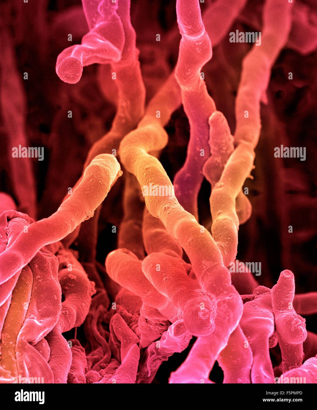 Streptomyces coelicoflavus bacteria. Coloured scanning electron micrograph (SEM) of strands of Streptomyces coelicoflavus Stock Photo