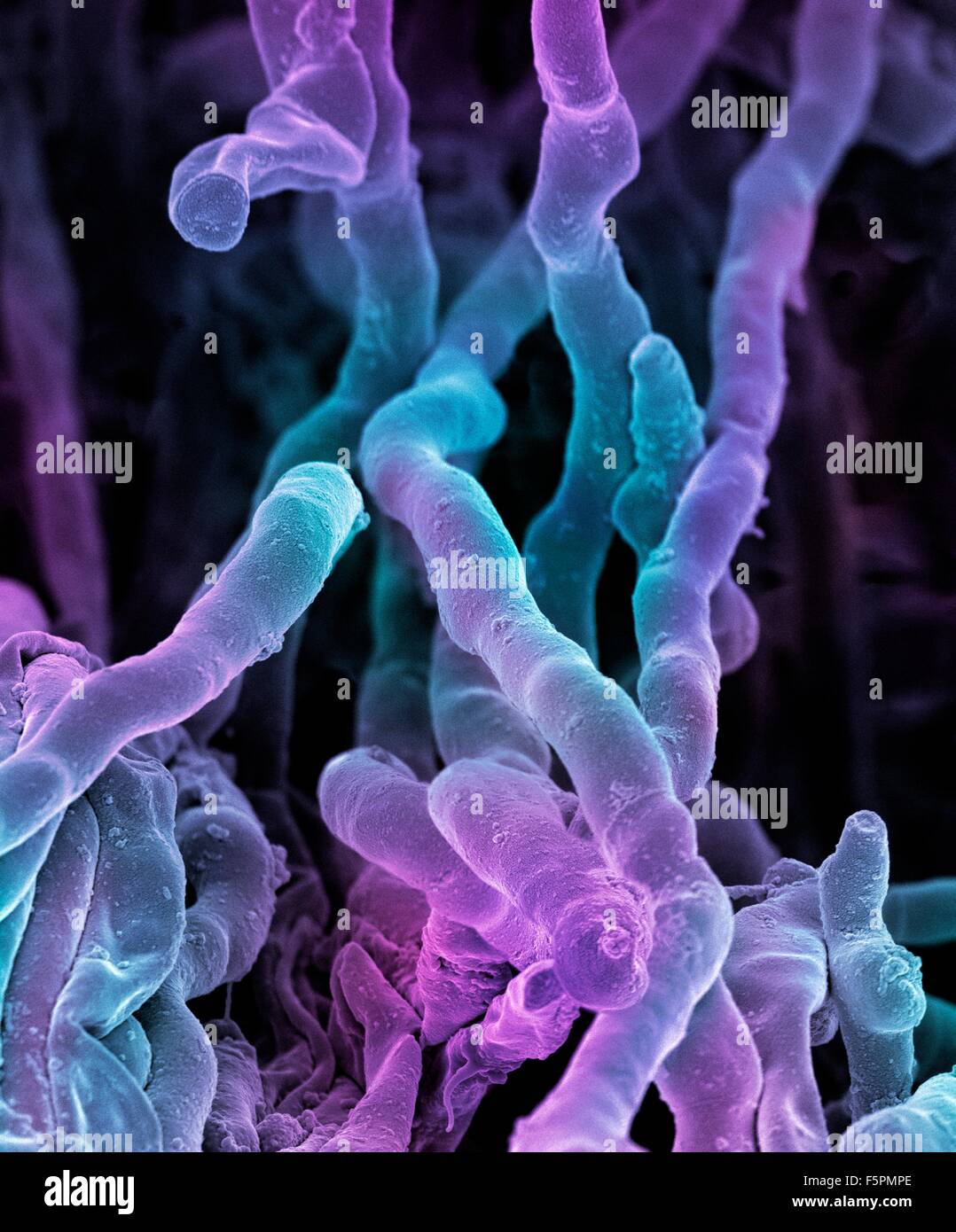 Streptomyces coelicoflavus bacteria. Coloured scanning electron micrograph (SEM) of strands of Streptomyces coelicoflavus Stock Photo