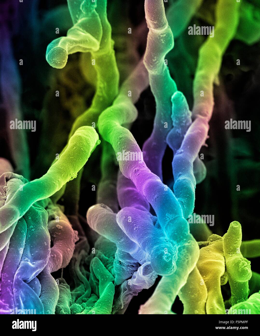 Streptomyces coelicoflavus bacteria. Coloured scanning electron micrograph (SEM) of strands of Streptomyces coelicoflavus Stock Photo