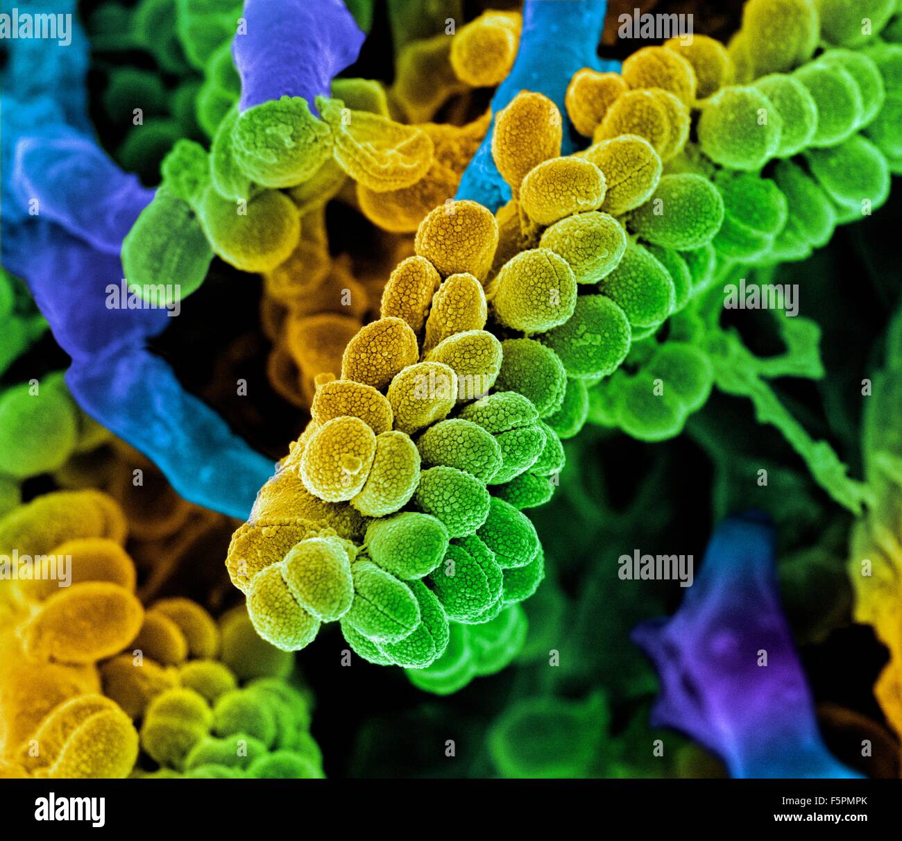 Streptococcus bacteria. Coloured scanning electron micrograph (SEM) of chains of Streptococcus bacteria with Streptomyces Stock Photo