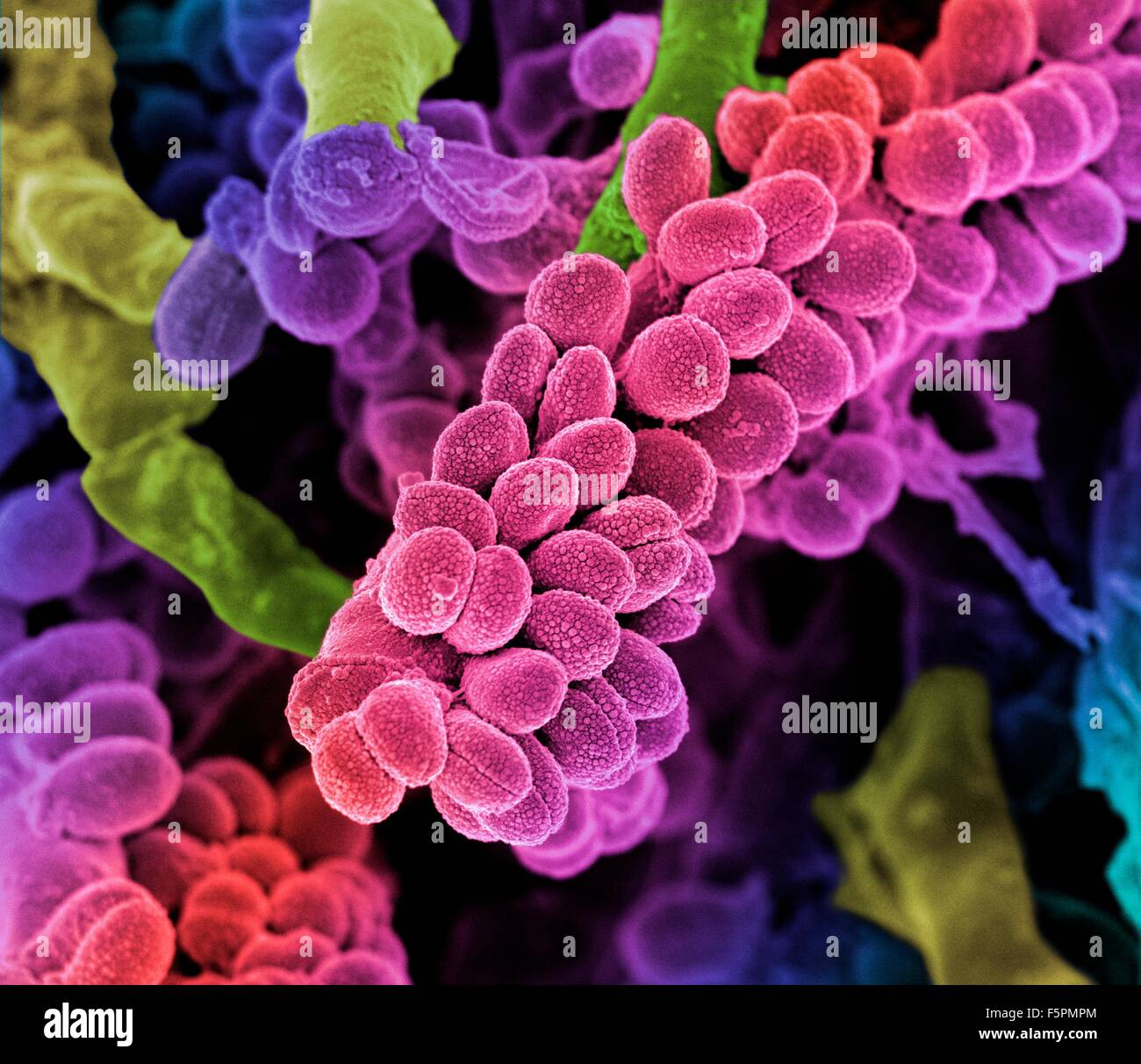 Streptococcus bacteria. Coloured scanning electron micrograph (SEM) of chains of Streptococcus bacteria with Streptomyces Stock Photo