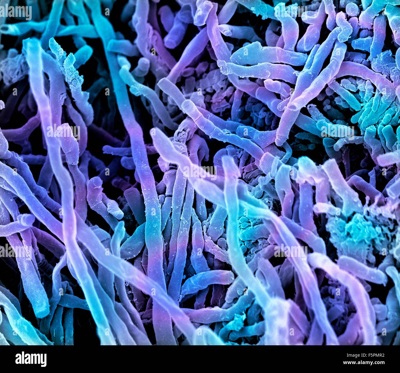 Streptomyces coelicoflavus bacteria. Coloured scanning electron ...