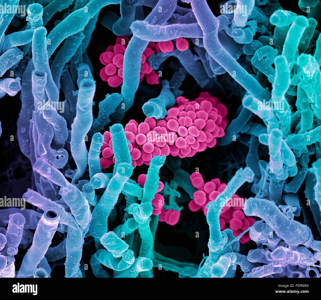 Streptomyces coelicoflavus bacteria. Coloured scanning electron micrograph (SEM) of Streptomyces coelicoflavus bacteria Stock Photo
