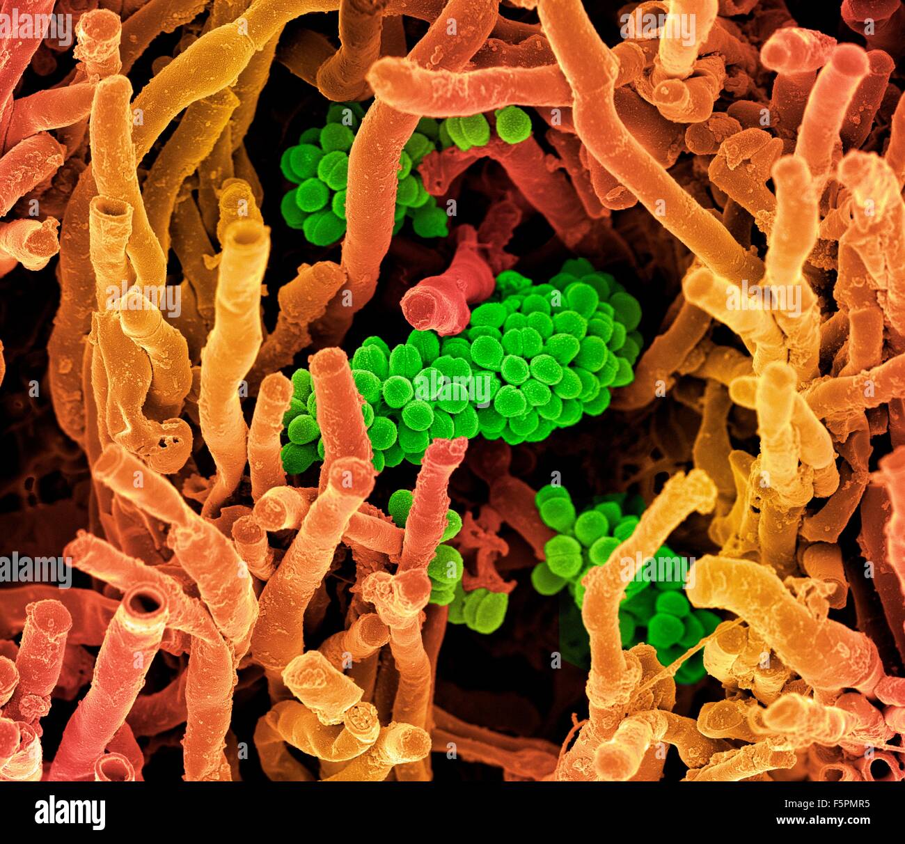 Streptomyces coelicoflavus bacteria. Coloured scanning electron micrograph (SEM) of Streptomyces coelicoflavus bacteria Stock Photo