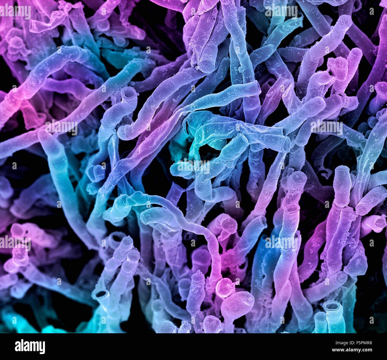 Actinomyces viscosus bacteria. Coloured scanning electron micrograph (SEM) of strands of Actinomyces viscosus. Actinomyces Stock Photo